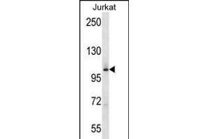 MAP4K2 anticorps  (AA 321-349)