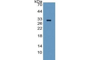 Western Blotting (WB) image for Fibrinogen alpha Chain (FGA) ELISA Kit (ABIN6574256)