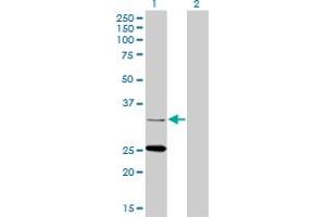 Western Blot analysis of STAR expression in transfected 293T cell line by STAR monoclonal antibody (M01A), clone 5F9. (STAR antibody  (AA 81-180))