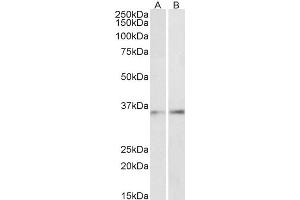 Image no. 1 for anti-CCAAT/enhancer Binding Protein (C/EBP), beta (CEBPB) (AA 68-81) antibody (ABIN5883747) (CEBPB antibody  (AA 68-81))