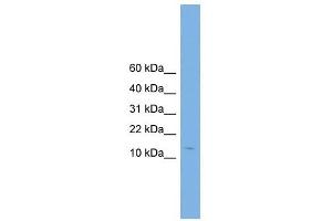 Complexin 2 antibody used at 1 ug/ml to detect target protein. (CPLX2 antibody  (N-Term))