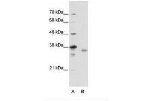 Image no. 2 for anti-Exosome Component 3 (EXOSC3) (C-Term) antibody (ABIN202145) (EXOSC3 antibody  (C-Term))