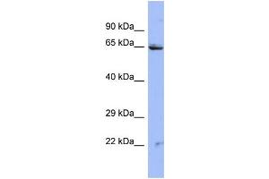 Host:  Rabbit  Target Name:  ZNF284  Sample Type:  HT1080 Whole cell lysates  Antibody Dilution:  1.
