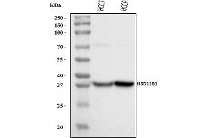 Western blot analysis of HSD11B1 using anti-HSD11B1 antibody (ABIN7601218).