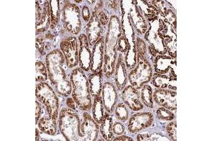 Immunohistochemical staining of human kidney with COQ9 polyclonal antibody  shows strong cytoplasmic positivity in renal tubules.