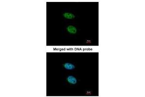 ICC/IF Image Immunofluorescence analysis of paraformaldehyde-fixed HeLa, using PRPS2, antibody at 1:200 dilution. (PRPS2 antibody)