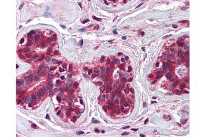 Immunohistochemistry (IHC) image for anti-Checkpoint with Forkhead and Ring Finger Domains (CHFR) (N-Term) antibody (ABIN2774757) (CHFR antibody  (N-Term))