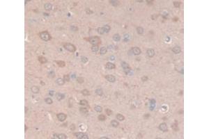IHC-P analysis of Rat Tissue, with DAB staining. (Prolactin antibody  (AA 30-226))