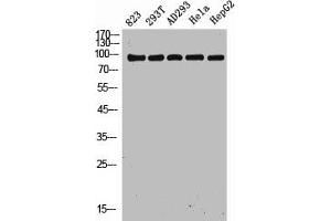 Western Blot analysis of 823 293T AD293 Hela HepG2 cells using NOXIN Polyclonal Antibody (C11orf82 antibody  (Internal Region))