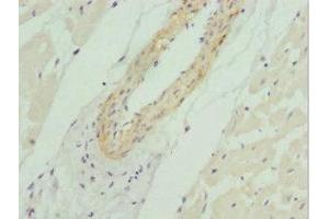 Immunohistochemistry of paraffin-embedded human heart tissue using ABIN7164754 at dilution of 1:100
