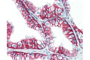 Anti-CD147 antibody IHC of human prostate.