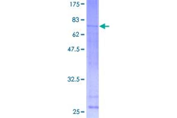 ATF6B Protein (AA 1-318) (GST tag)