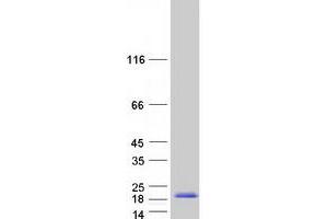 Western Blotting (WB) image for Regenerating Islet-Derived 1 alpha (REG1A) protein (Myc-DYKDDDDK Tag) (ABIN2730683)