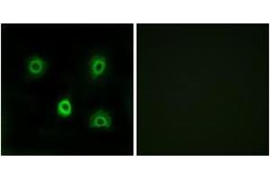 Immunofluorescence analysis of A549 cells, using ABHD6 Antibody.