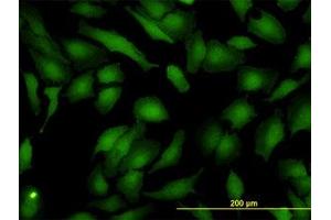 Image no. 4 for anti-ArsA Arsenite Transporter, ATP-Binding, Homolog 1 (ASNA1) (AA 239-349) antibody (ABIN598547) (ASNA1 antibody  (AA 239-349))