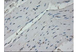 Immunohistochemical staining of paraffin-embedded colon tissue using anti-RPA2 mouse monoclonal antibody. (RPA2 antibody)