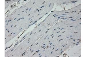 Immunohistochemical staining of paraffin-embedded colon tissue using anti-RPA2 mouse monoclonal antibody. (RPA2 antibody)
