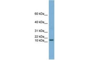 Image no. 1 for anti-Harakiri, BCL2 Interacting Protein (Contains Only BH3 Domain) (HRK) (N-Term) antibody (ABIN6743246) (HRK antibody  (N-Term))