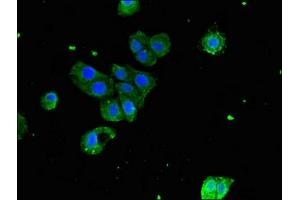 Immunofluorescence (IF) image for anti-Serpin Peptidase Inhibitor, Clade G (C1 Inhibitor), Member 1 (SERPING1) (AA 23-300) antibody (ABIN7163524)