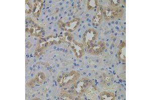 Immunohistochemistry of paraffin-embedded rat kidney using ARF1 antibody. (ARF1 antibody)