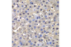 Immunohistochemistry (IHC) image for anti-Dihydrofolate Reductase (DHFR) (AA 1-187) antibody (ABIN3022228) (Dihydrofolate Reductase antibody  (AA 1-187))