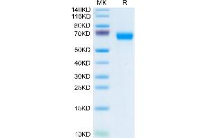 Human LCAT on Tris-Bis PAGE under reduced condition. (LCAT Protein (AA 25-440) (His tag))