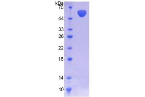 SDS-PAGE (SDS) image for NAD Kinase (NADK) (AA 187-426) protein (His tag,GST tag) (ABIN6237215)