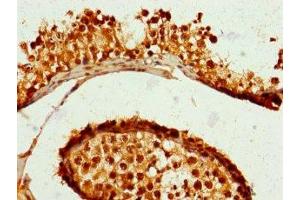 Immunohistochemistry of paraffin-embedded human testis tissue using ABIN7176477 at dilution of 1:100 (ZNF679 antibody  (AA 1-300))