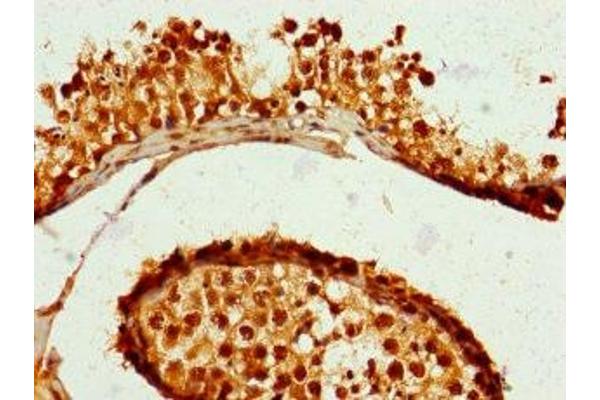 ZNF679 antibody  (AA 1-300)