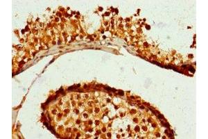 Immunohistochemistry of paraffin-embedded human testis tissue using ABIN7176477 at dilution of 1:100