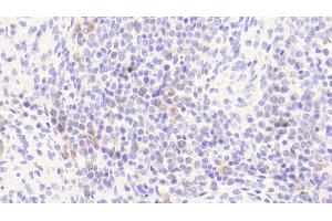 Detection of PRKAb1 in Human Spleen Tissue using Polyclonal Antibody to Protein Kinase, AMP Activated Beta 1 (PRKAb1) (PRKAB1 antibody  (AA 13-242))