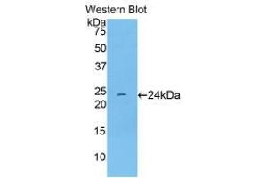Western blot analysis of recombinant Rat TNNI1. (TNNI1 antibody  (AA 1-187))