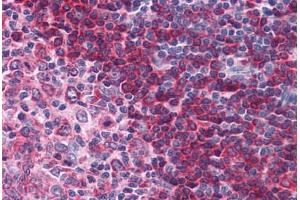 Human Tonsil: Formalin-Fixed, Paraffin-Embedded (FFPE) (BTK antibody  (AA 91-387))