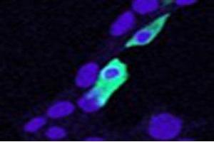 Immunofluorescence (IF) image for Chloride Intracellular Channel 4 (CLIC4) peptide (ABIN370258)