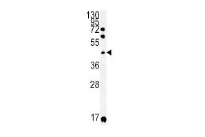Western blot analysis in A2058 cell line lysates (35ug/lane). (KIR2DS2 antibody  (AA 39-65))