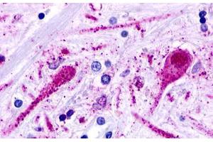Image no. 1 for anti-Trace Amine Associated Receptor 2 (TAAR2) (Cytoplasmic Domain) antibody (ABIN1049380) (GPR58 antibody  (Cytoplasmic Domain))
