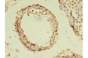 Immunohistochemistry of paraffin-embedded human testis tissue using ABIN7174767 at dilution of 1:100 (C19orf47 antibody  (AA 1-281))