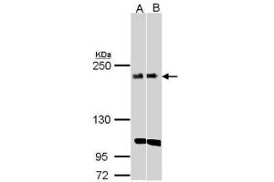 WB Image Sample(30 ug whole cell lysate) A:H1299 B:Raji , 5% SDS PAGE antibody diluted at 1:1000 (KIDINS220 antibody  (C-Term))