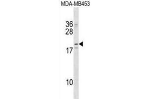Western Blotting (WB) image for anti-Na+/K+ Transporting ATPase Interacting 2 (NKAIN2) antibody (ABIN2998903)