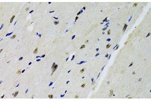 Immunohistochemistry of paraffin-embedded Mouse heart using DOK1 Polyclonal Antibody at dilution of 1:100 (40x lens). (DOK1 antibody)