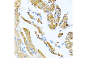 Immunohistochemistry of paraffin-embedded mouse heart using COL9A3 antibody at dilution of 1:100 (40x lens). (COL9A3 antibody)