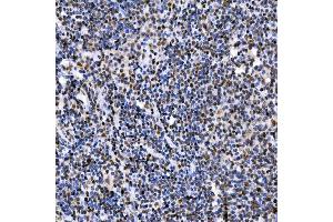 IHC analysis of SAE1 using anti-SAE1 antibody (ABIN7601346). (SAE1 antibody  (AA 33-299))