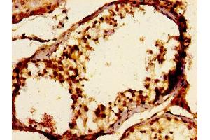 Immunohistochemistry of paraffin-embedded human testis tissue using ABIN7157174 at dilution of 1:100 (JAM3 antibody  (AA 119-235))
