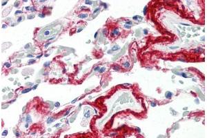 Human Lung (formalin-fixed, paraffin-embedded) stained with TIMP3 antibody ABIN337298 at 10 ug/ml followed by biotinylated anti-mouse IgG secondary antibody ABIN481714, alkaline phosphatase-streptavidin and chromogen. (TIMP3 antibody  (AA 170-188))