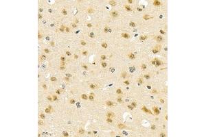 Immunohistochemistry of paraffin embedded mouse brain using PGBD5 (ABIN7075082) at dilution of 1:2000 (400x lens) (PGBD5 antibody)
