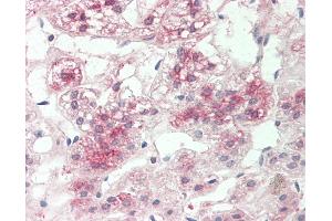 Human Adrenal: Formalin-Fixed, Paraffin-Embedded (FFPE). (P4HB antibody  (AA 101-150))