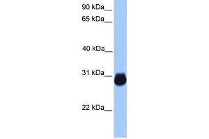 WB Suggested Anti-IGFBP7 Antibody Titration:  0. (IGFBP7 antibody  (C-Term))
