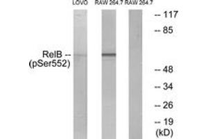 Western blot analysis of extracts from LOVO cells and RAW264. (RELB antibody  (pSer573))