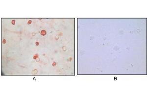 Immunocytochemistry analysis of TPA induced BCBL-1 cells (A) and uninduced BCBL-1 cells (B) using KSHV K8α mouse mAb with AEC staining. (KSHVK8a antibody)