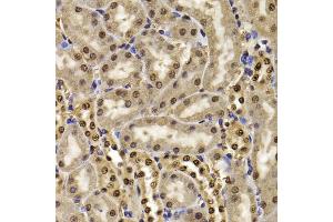 Immunohistochemistry of paraffin-embedded mouse kidney using HIRIP3 antibody (ABIN5974221) at dilution of 1/100 (40x lens). (HIRIP3 antibody)